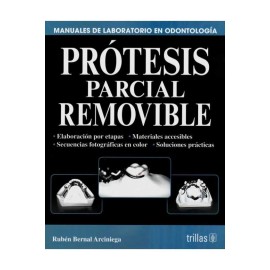 Prótesis Parcial Removible