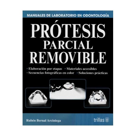 Prótesis Parcial Removible