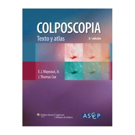 COLPOSCOPIA TEXTO Y ATLAS